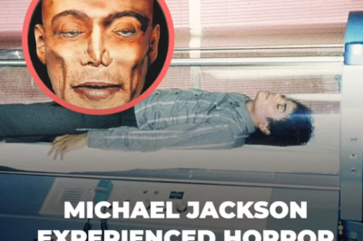 The Forensic Analysis of Michael Jackson’s Remains: A Life of Struggles, Treatments, and Untimely End
