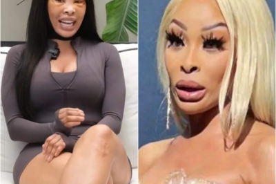 It ends in tears for Khanyi Mbau who wanted to upgrade her beauty via plastic surgery